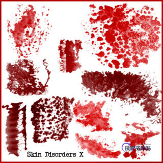 有疾病的皮肤纹理、皮肤创伤、化脓、炎症、擦伤等纹理PS笔刷素材-玩吧资源站